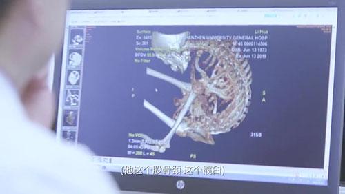身體被敲斷4次的折疊人出院,打開折疊人生(圖6) 身體被敲斷4次的折疊人出院,打開折疊人生(圖6)