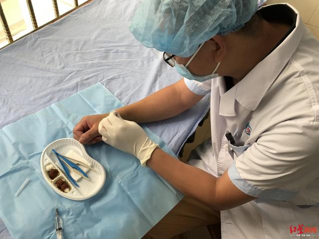 遂寧一院“狠醫生”左手給右手做手術，術后第二天就工作